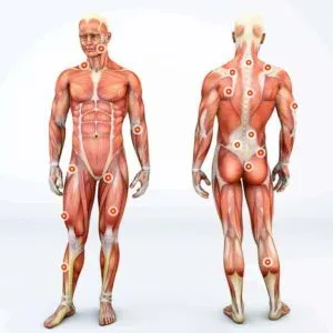 Fascia Human Body Diagram showing knots and pain points