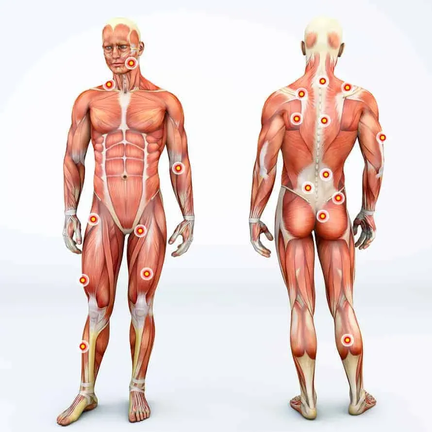 Fascia Human Body Diagram showing knots and pain points